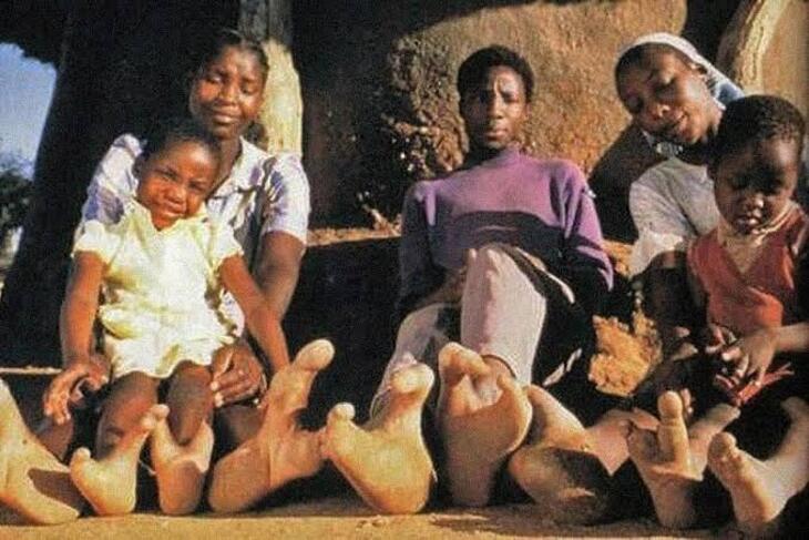 The Vadoma Of Zimbabwe Have Only Two Toes